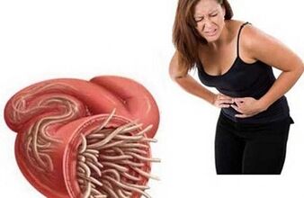 kaip pašalinti parazitus iš organizmo