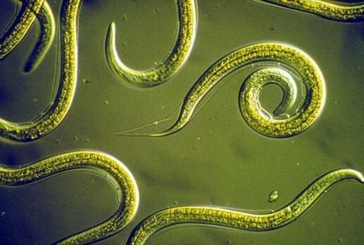 Parazitiniai nematodai, gyvenantys žmogaus plonojoje žarnoje